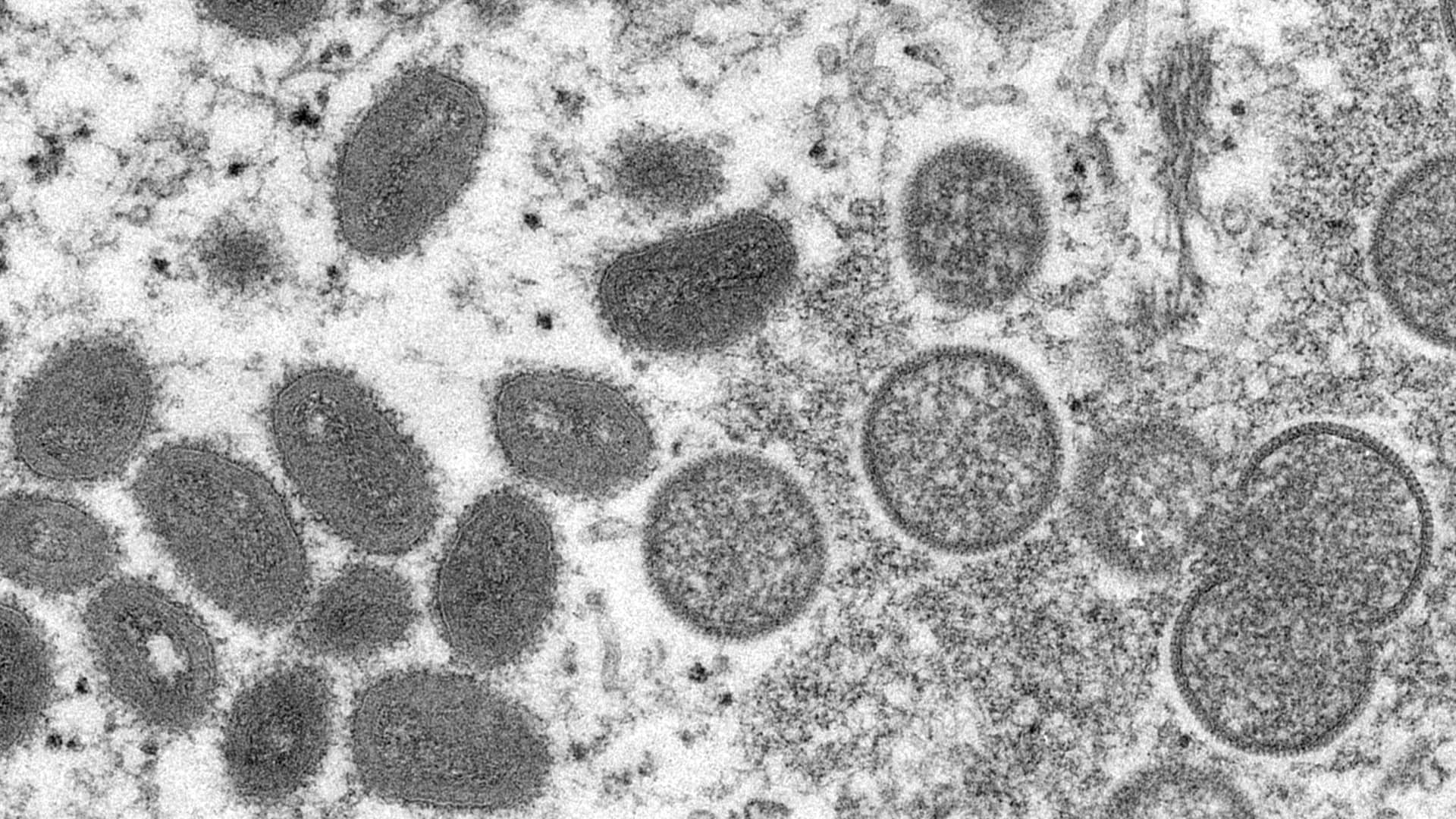 WHO confirms 80 cases of monkeypox with outbreaks in 11 countries